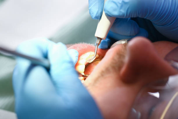 Best Emergency Treatment for Oral Infections in Racend, LA