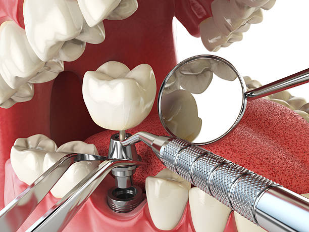 Best Emergency Care for Gum Disease in Racend, LA