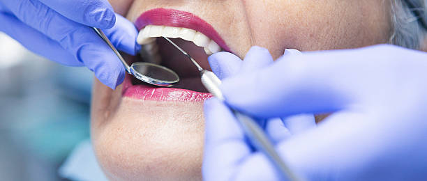Best Dental Abscess Treatment in Racend, LA